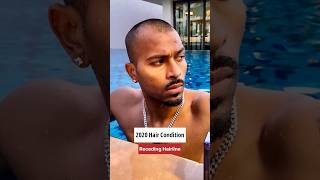 Hardik pandya Hair Transplant Journey #hair #hairtransplant #celebrity #shorts Resimi