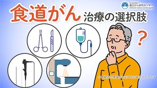 【食道がん】ステージに合わせた治療の選択肢と治療法を徹底解説!