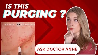 Is your skin purging or just irritated? | Ask Doctor Anne