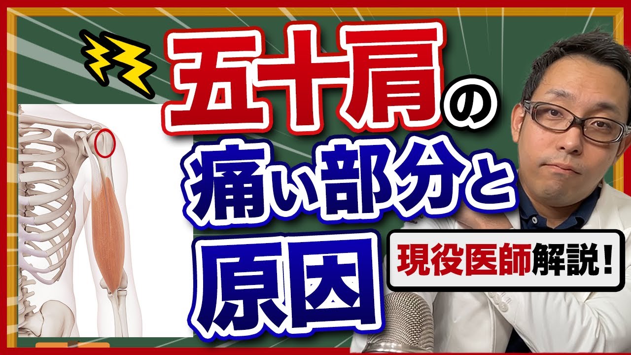【医師解説】五十肩の痛い部位と原因をセルフチェックして、その対処法を徹底解説