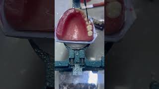 Arrangement of posterior teeth part 6