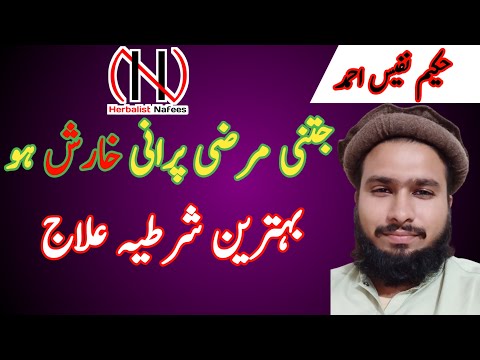 خارش کا علاج | Kharish ka ilaj | Kharis | Herbalist Nafees