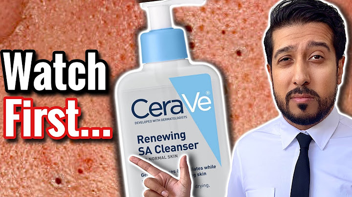 Cerave renewing sa cleanser review acne năm 2024