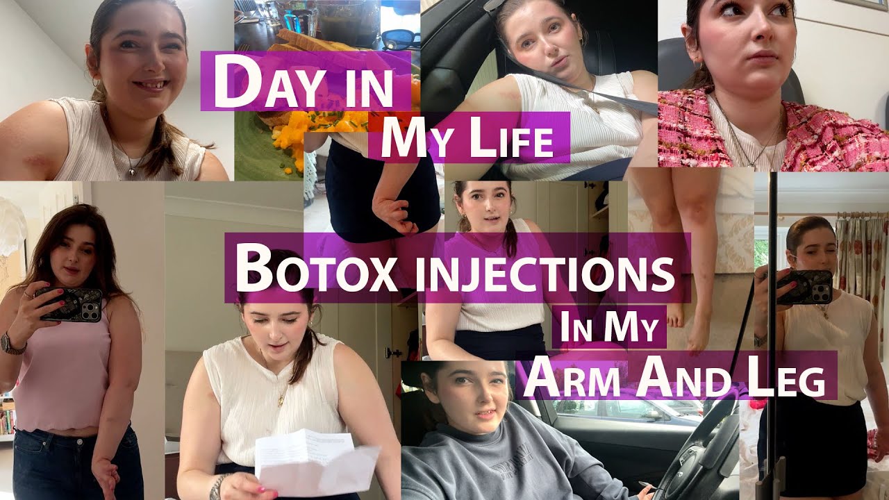 A Day in My Life with Hemiplegia (my disability) When I Go To Hospital ...