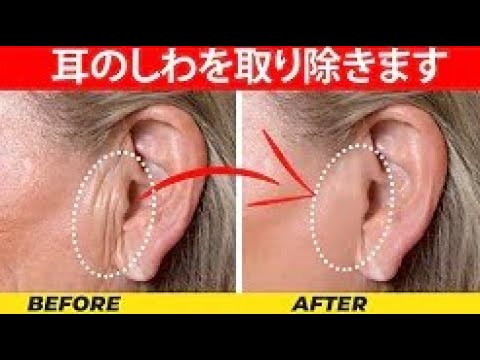 自宅で耳のしわを取り除くのに役立つ6つのステップ、ナチュラルビューティーメソッド - YouTube