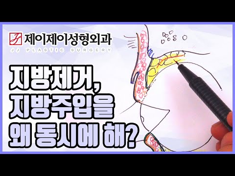<strong>지방제거</strong>, 지방주입을 왜 동시에 해