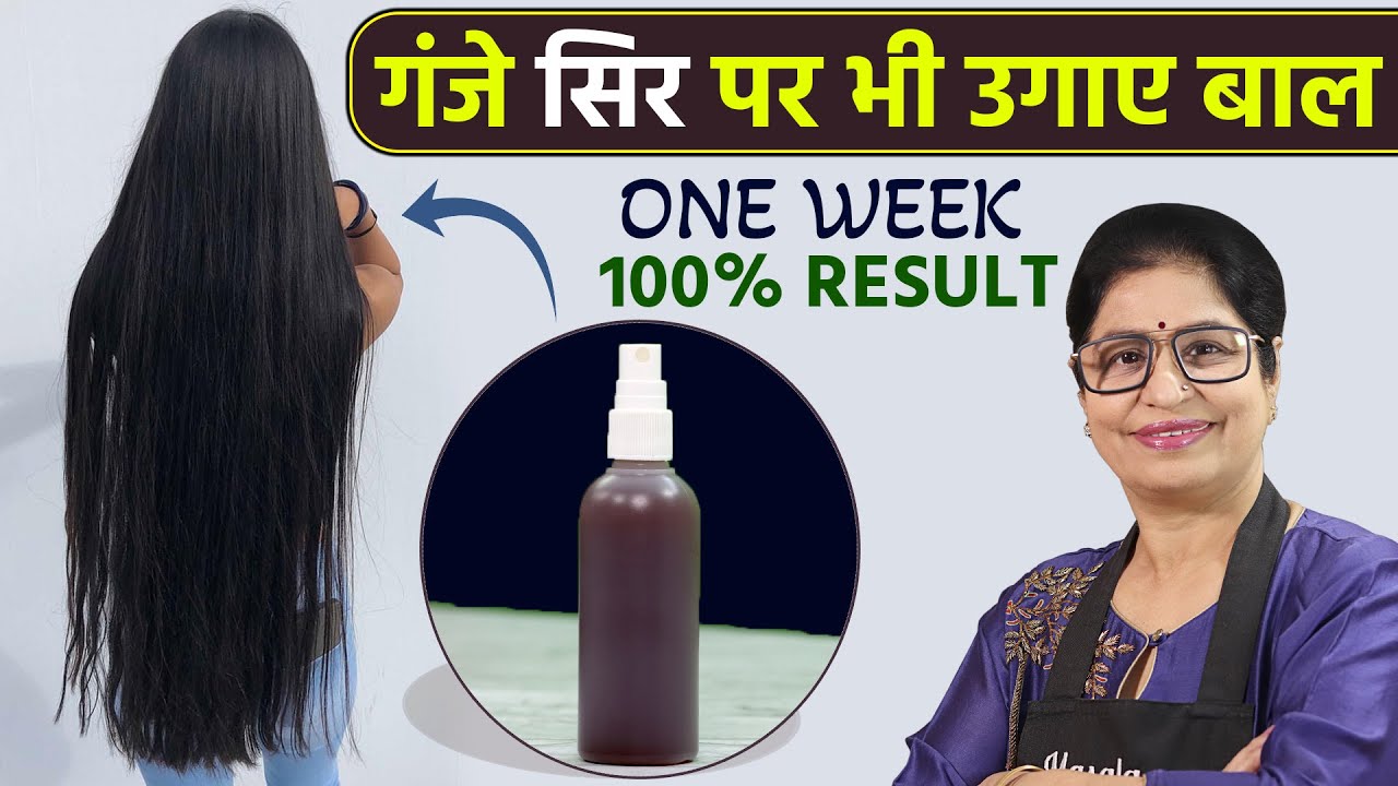 गज हन क बद जलद बल कस उगए  नए बल उगन क 10 घरल उपय 2023   how to grow hair after baldness in hindi  techhindiakv