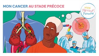 4 - Mon Parcours Poumon : Mon cancer au stade précoce