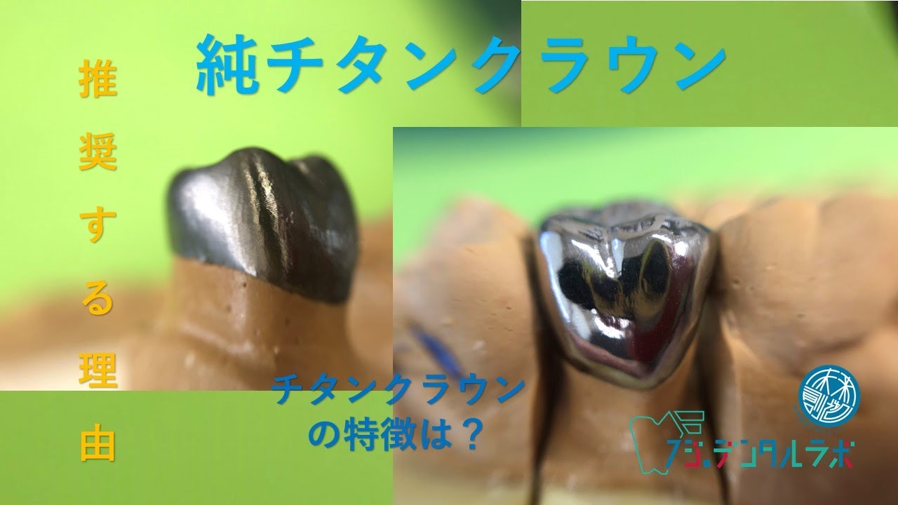 フジデンタル 純チタンクラウンを推奨理由 歯科技工所 005 - YouTube