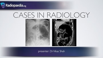 Casussen in de radiologie: aflevering 6 (abdominale spoed, röntgenfoto, CT)