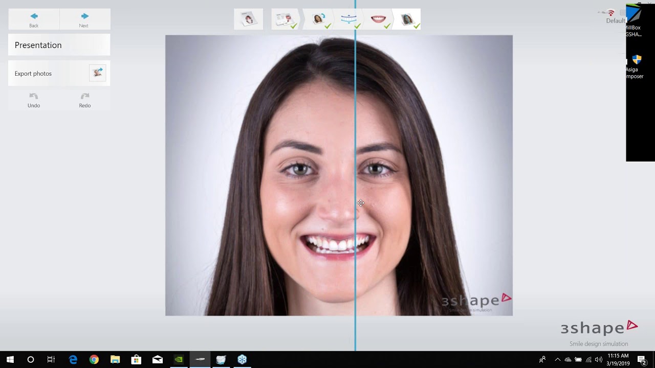 [Webinar] Smile Design in 3Shape: An Overview with Brandon Smith, CDT ...