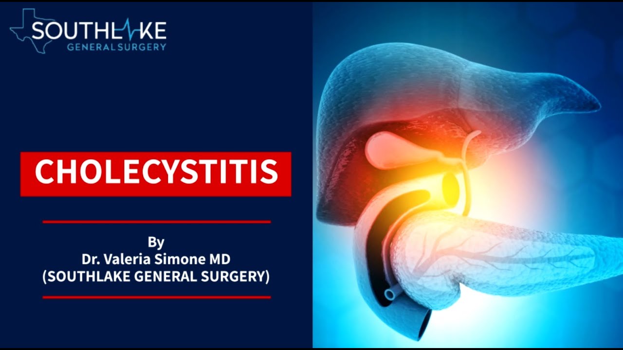 cholecystitis-causes-symptoms-treatment-and-surgery-youtube