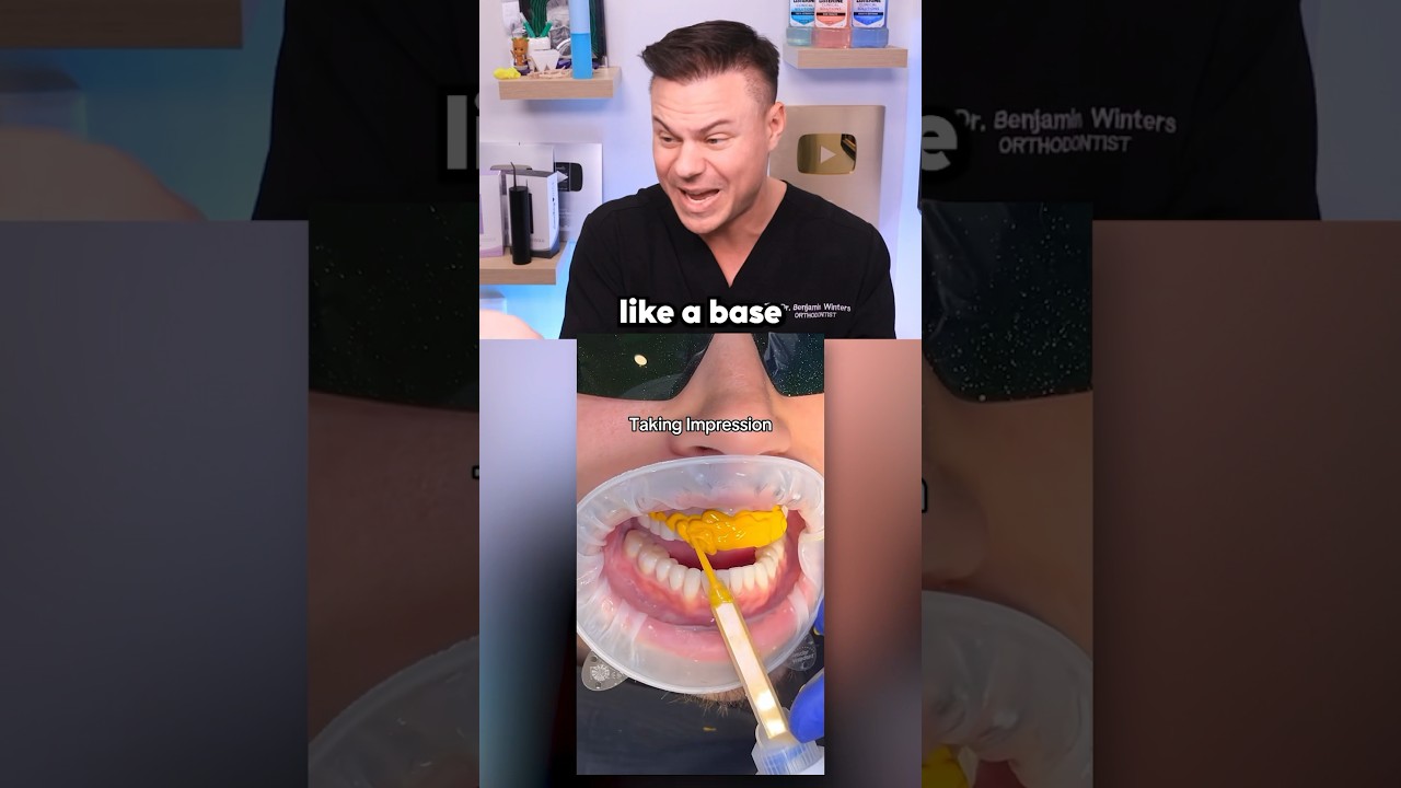 Dentist Reveals What REALLY Happens Before Getting Veneers! 😬🪥