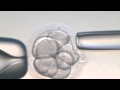 Procedimentos de Fertilização in vitro - Vídeo Completo