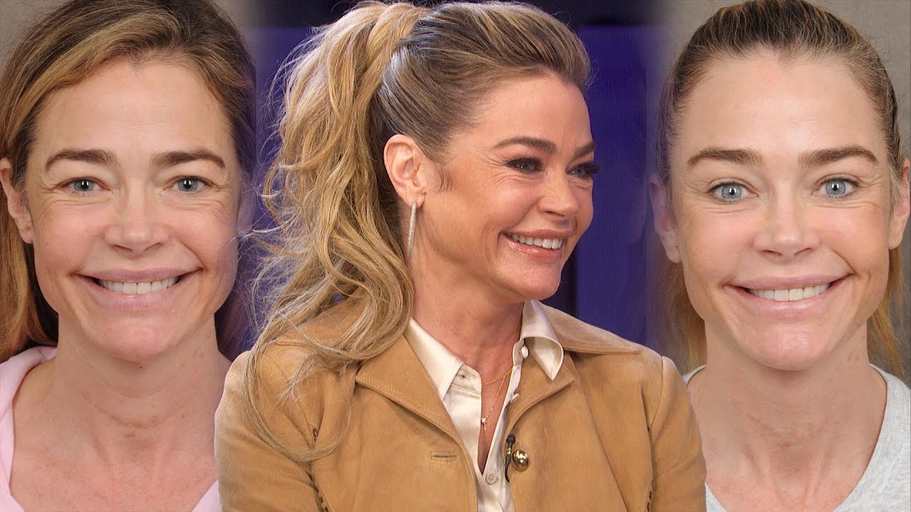 Denise Richards Shares SHOCKING Facelift Before and After Transformation