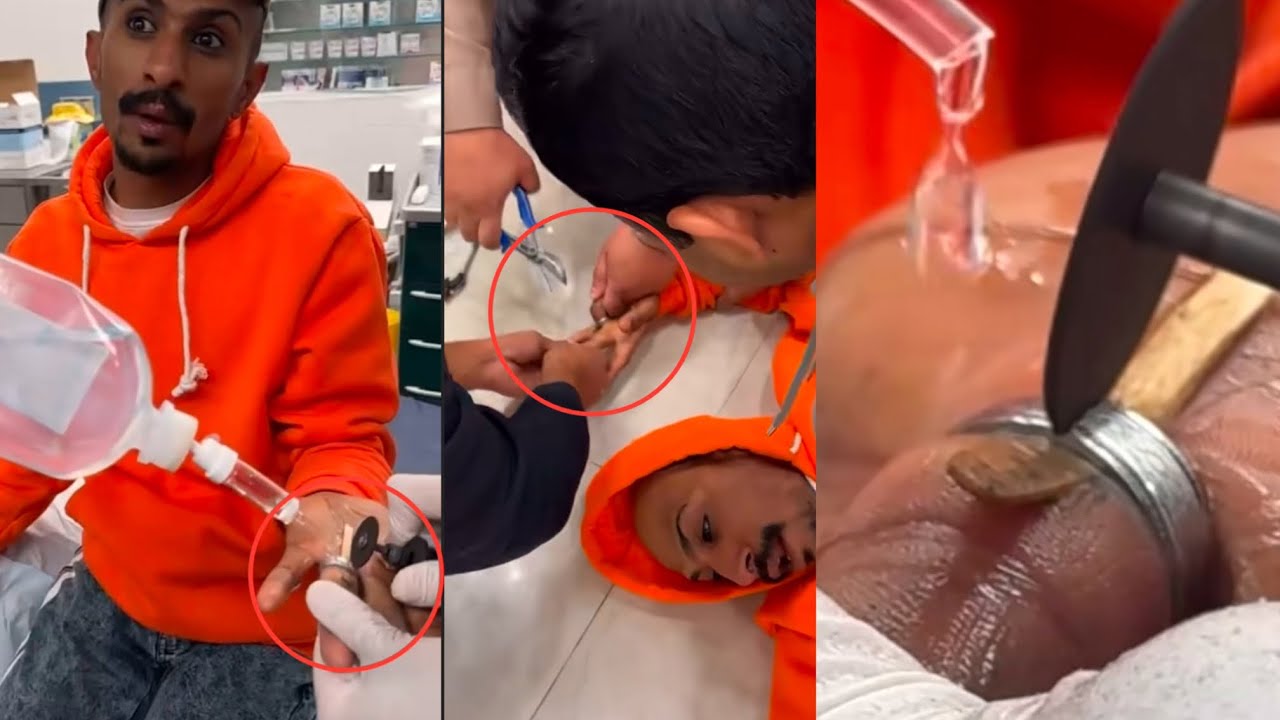 كل المحاولات بائت بالفشل بوماجد توهق وجابو الدفاع المدني يفكون الدبلة 🤣🤣🤣 #ابتاه