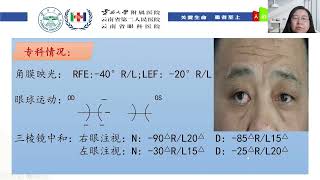 演讲：甲状腺相关眼病——斜视手术的思考