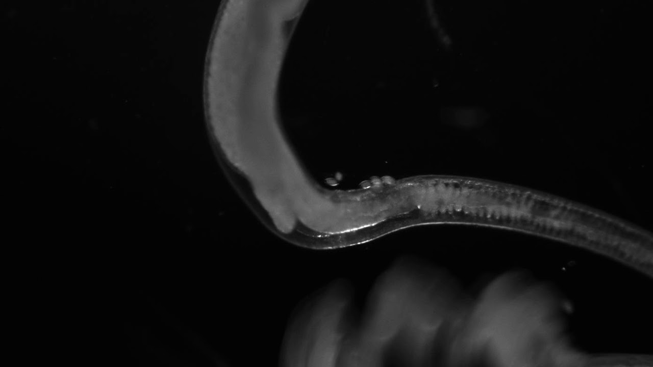 Female whipworm releasing eggs YouTube