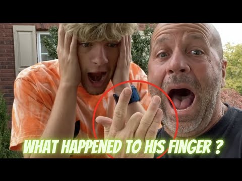 What happened to his finger ?! 😳 #magic #magican #viralvideo