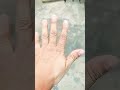 5 ghanta whataap chalate hai #funny #wildliferescue #nonfollowers #comedy #shortsviral #video