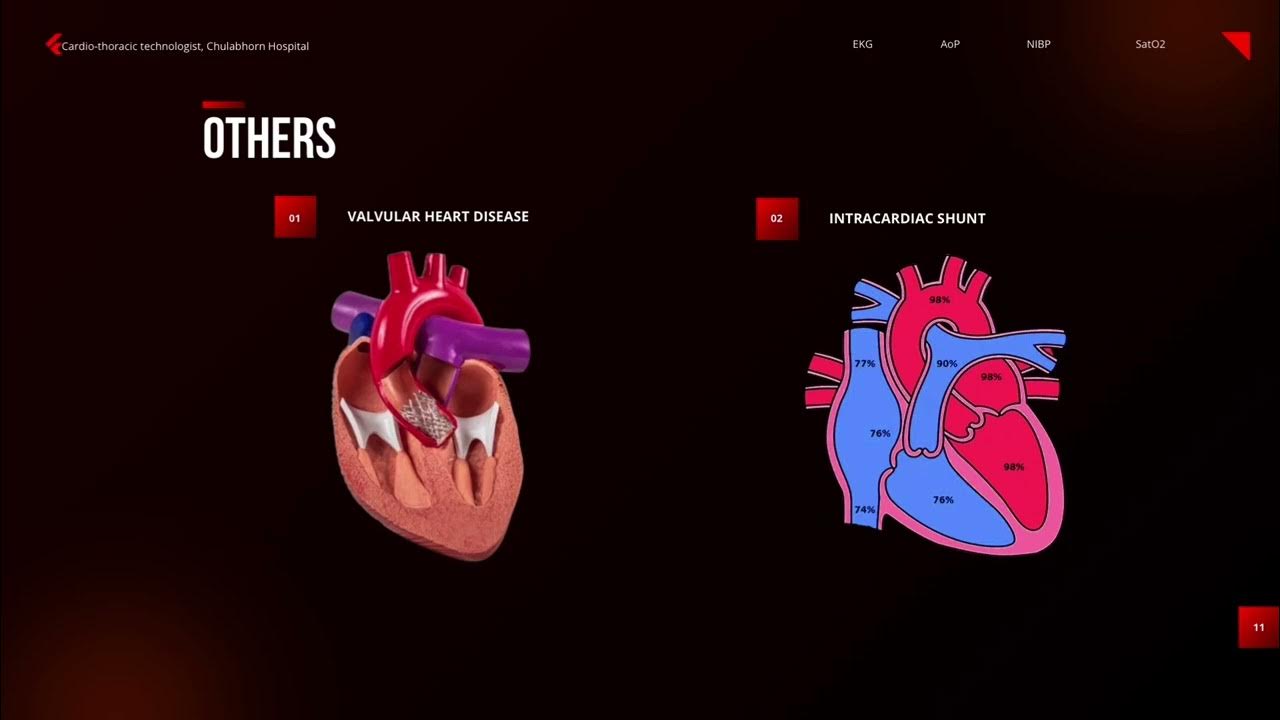 HEMODYNAMIC MONITORING IN CATH LAB YouTube