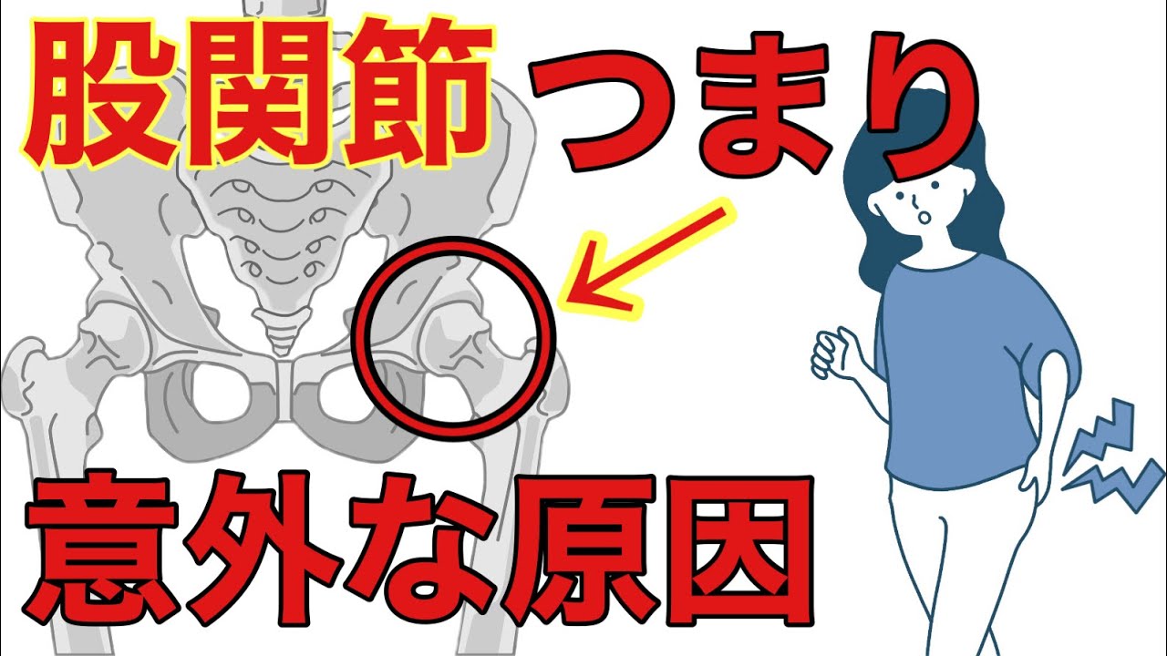 股関節 つる 原因 – 股関節 つる 治し方 – OHEUOY