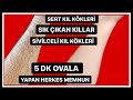 VÜCUT KILLARINDAN SONSUZA KADAR KURTULMAK İSTİYORSAN HEMEN BU KÜRÜ YAP| EVDE Kİ MALZEMELERLE - BAKIM