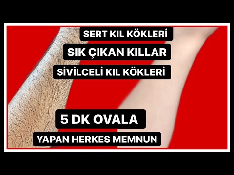 Video: Sonsuza Dek Kocandan Nasıl Kurtulursun