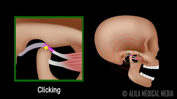 How do you test for TMJ?