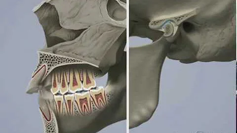 Come si correggere la malocclusione?