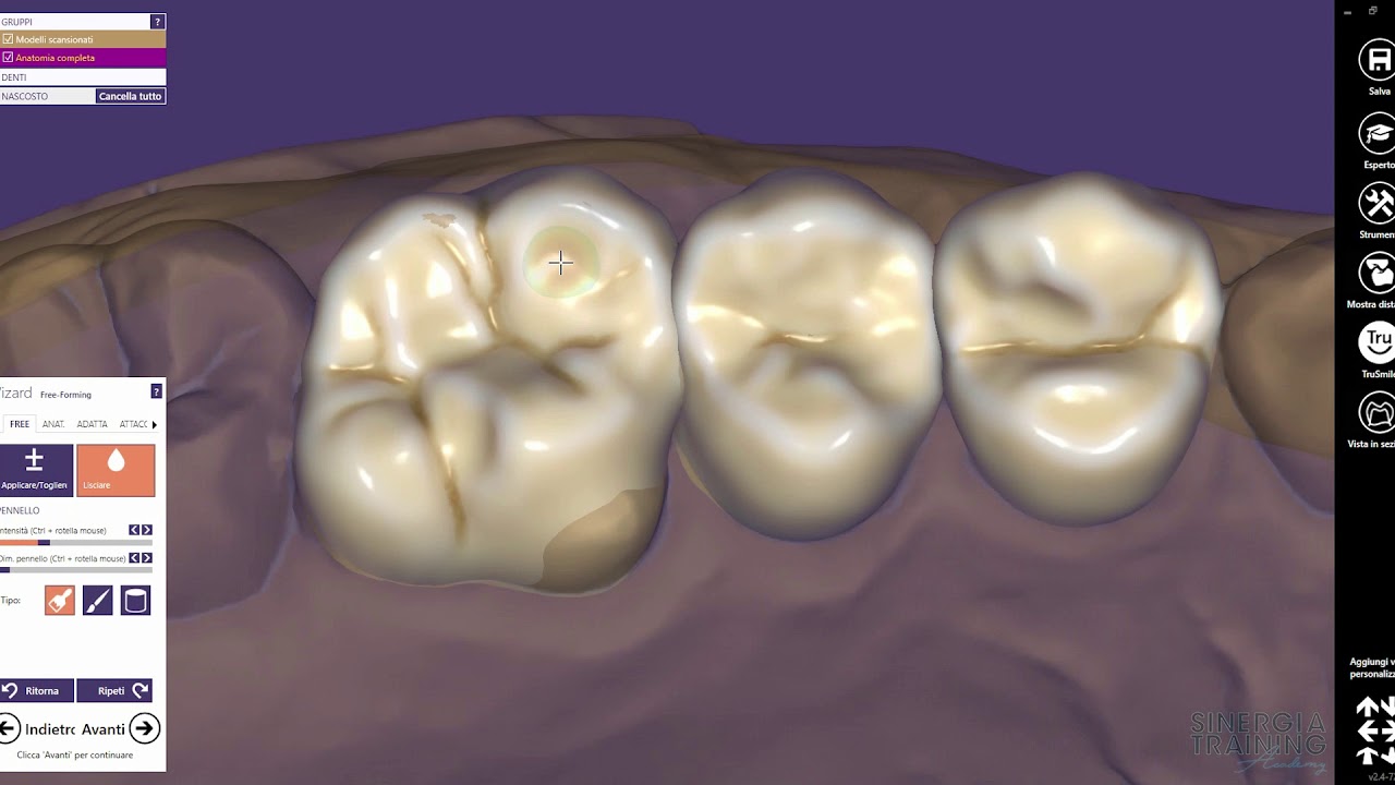 Antonio Scaffidi : il provvisorio