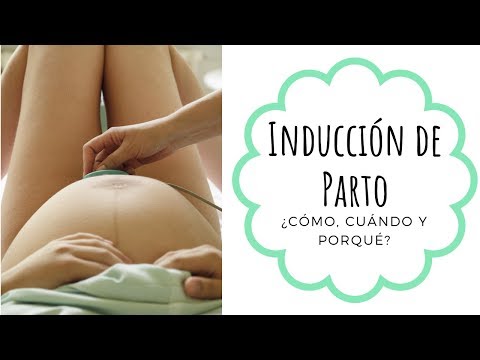 Video: ¿Cómo se induce el parto de inmediato?