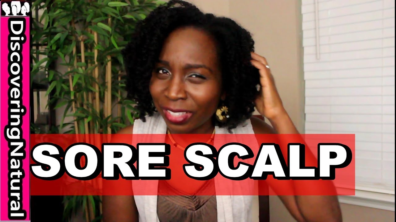 Sore Scalp What Causes Sore Scalp Youtube Sores On Scalp Youtube Hair Tutorials Soreness [ 720 x 1280 Pixel ]