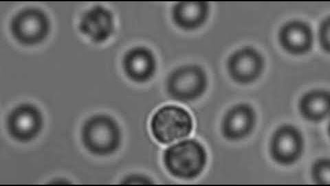 Using optical tweezers to manipulate blood cells.