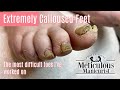 👣How To Pedicure Extremely Calloused Feet - The Most Difficult Toes I Have Worked On👣