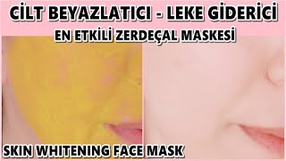 LEKELER GİTTİ - YÜZÜM BEMBEYAZ OLDU! LEKE GİDERİCİ, CİLT BEYAZLATICI ZERDEÇAL MASKESİ