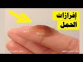 اسباب نزول افرازات بنية قبل الدورة وهل تدل على حمل
