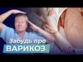 ВАРИКОЗ? Не БЕДА! Делайте ЭТО УПРАЖНЕНИЕ каждый день и ЗАБУДЬТЕ ПРО ВАРИКОЗ!