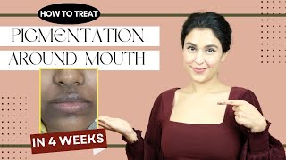 How To Treat PIGMENTATION Around Mouth | Chetali Chadha