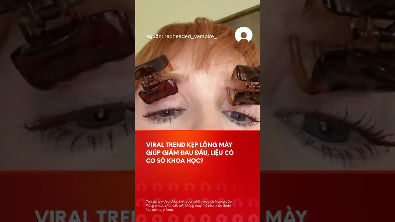 Viral trend káº¹p lÃ´ng mÃ y giÃºp giáº£m Ä‘au Ä‘áº§u! #viral