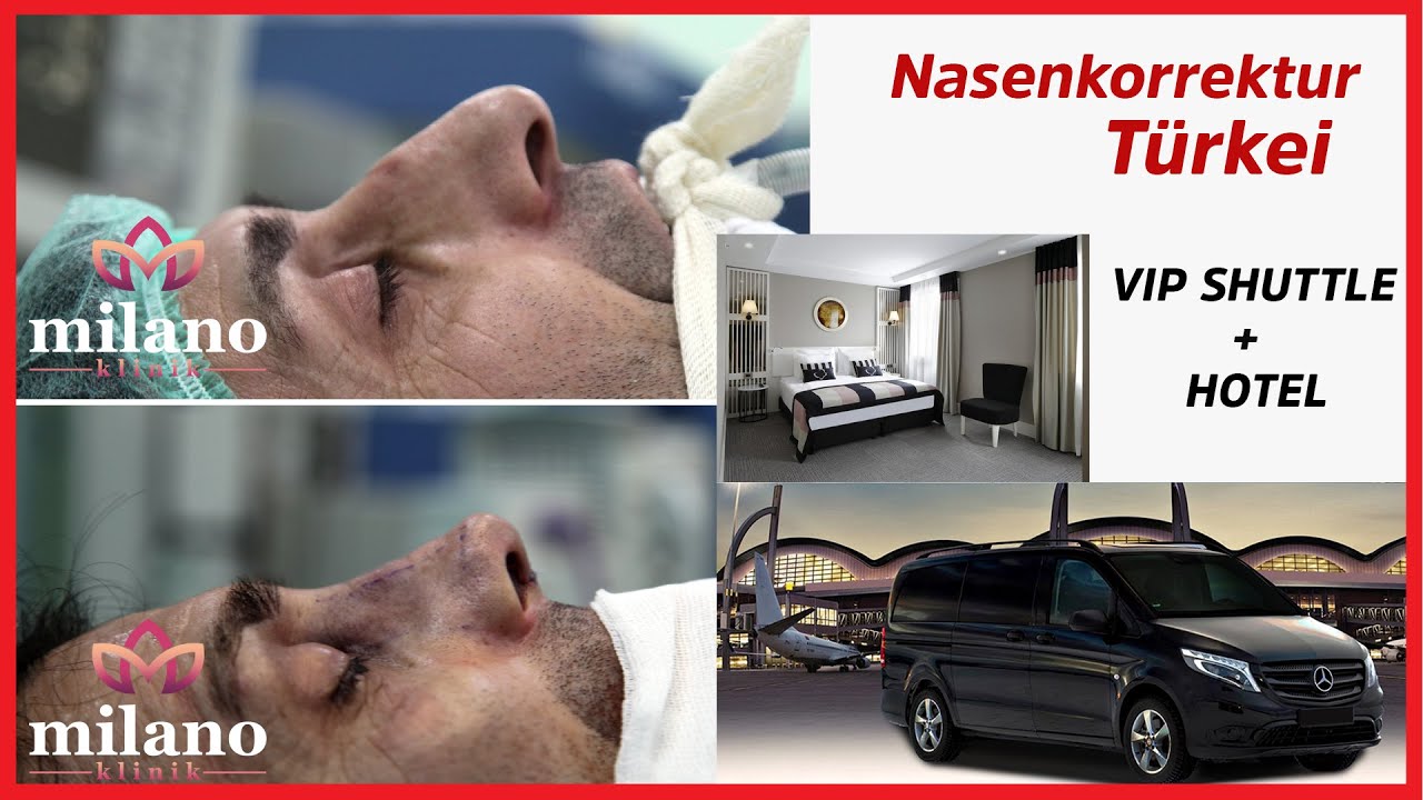 Nasenkorrektur (Nasen Op) Vorher Nachher in Istanbul Milano Clinic Türkei