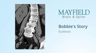 Mayfield Brain & Spinal Column