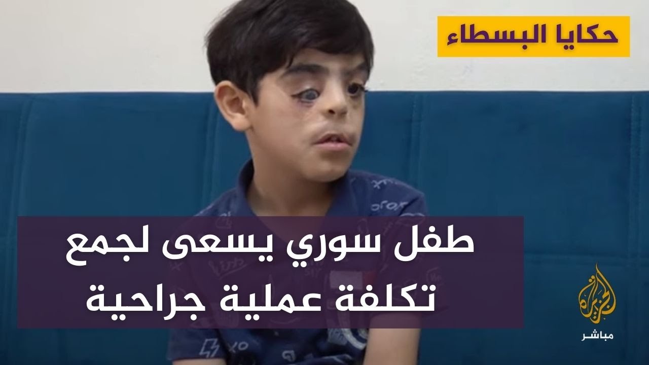 سراج الدين.. طفل سوري يسعى لجمع تكلفة عملية جراحية تخلصه من التشوه الخلقي