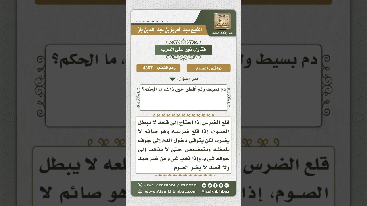 4357 - حكم قلع ضرس الصائم وابتلاع شيء من الدم - نور على الدرب