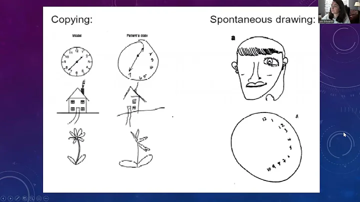 Right Hemisphere