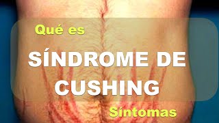 Síndrome de Cushing. Síntomas. Explicación