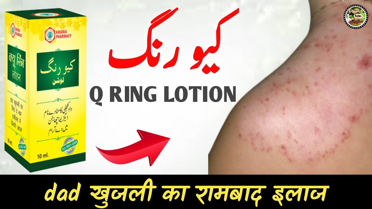 Q-RING ANTI FUNGAL LOTION FOR SKIN TREATMENT SPECIALLY FOR RINGWORM ITCHES  AND ECZEMA 30 ML PACK * 6 PCS PACK Price in India - Buy Q-RING ANTI FUNGAL  LOTION FOR SKIN TREATMENT