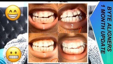 Byte Aligners: 1 Month Update | Ben and Cin