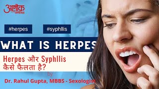 Unprotected Sex से सिर्फ़ Herpes नहीं, Syphilis नाम का ख़तरनाक STI हो सकता है | Dr. Rahul Gupta