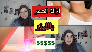 ازالة الشعر بالليزر (لازم تشوفي الفيديو) | Laser Experience